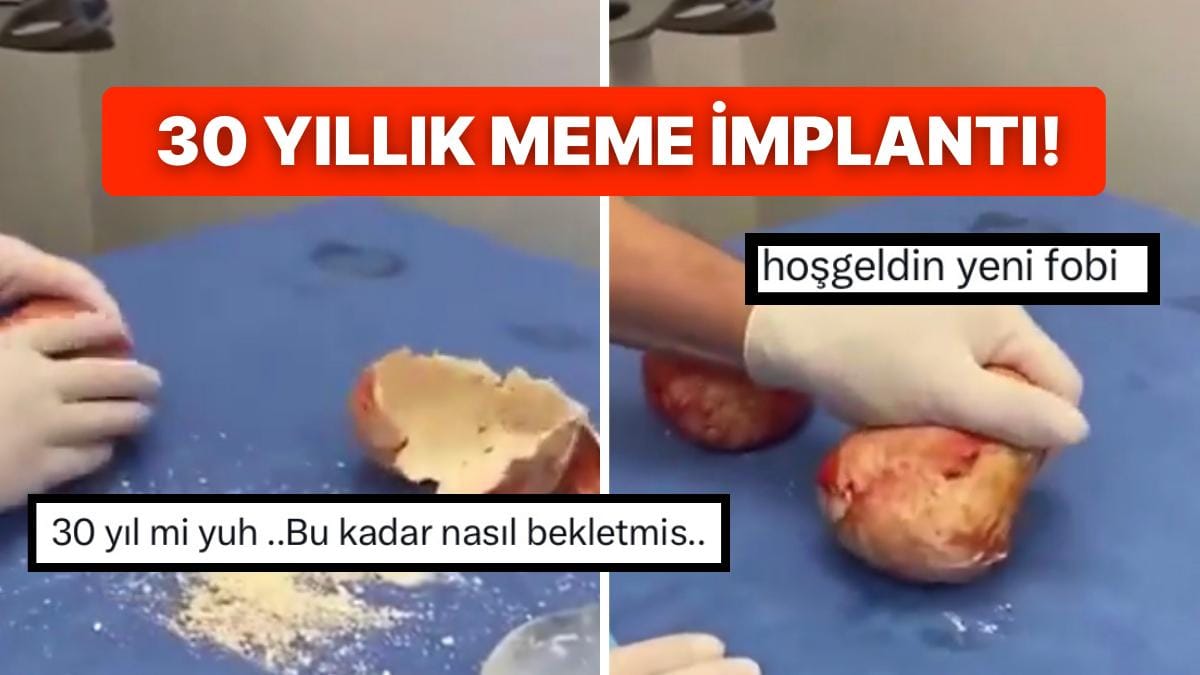 30-yillik-bir-gogus-implantindaki-kireclenmeyi-gosteren-doktor-yeni-fobi-kilitlerini-acti-giKRhHK6.jpg