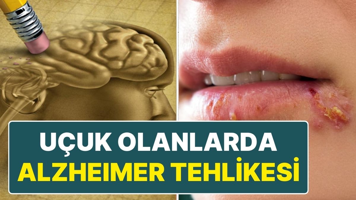 ucuk-virusu-ve-alzheimer-arasindaki-iliski-yeni-arastirma-bulgulari-fJRwLWlO.jpg